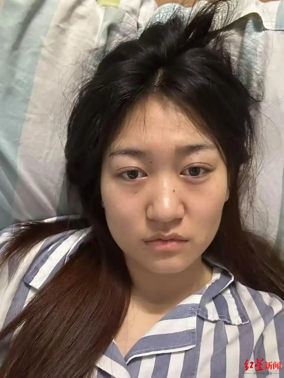 公厕被打女孩家庭已无力承担医疗费_公厕殴打案受害女孩小徐_急性淋巴细胞白血病骨髓移植求助