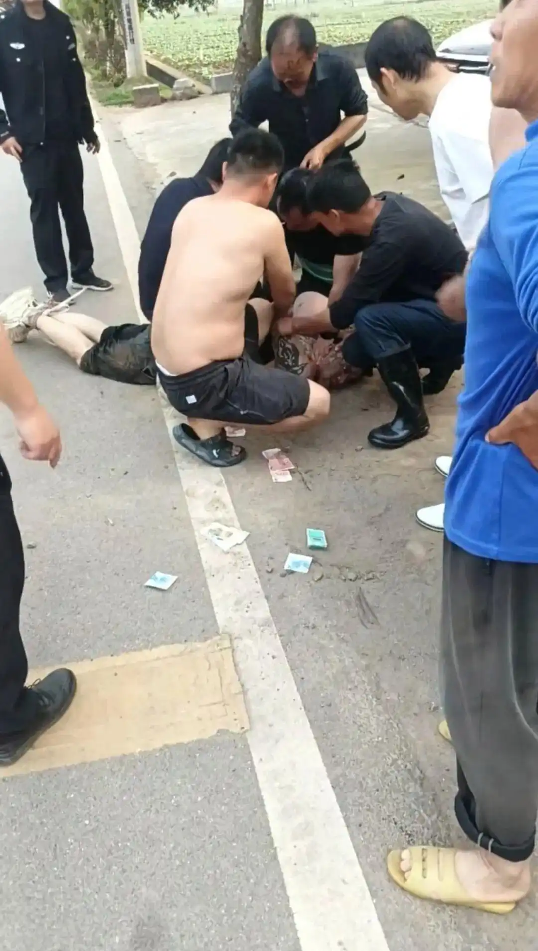 中央政法委见义勇为勇士榜2026_老人为救女子被咬掉鼻子 本人发声_湖南大爷见义勇为鼻子被咬掉